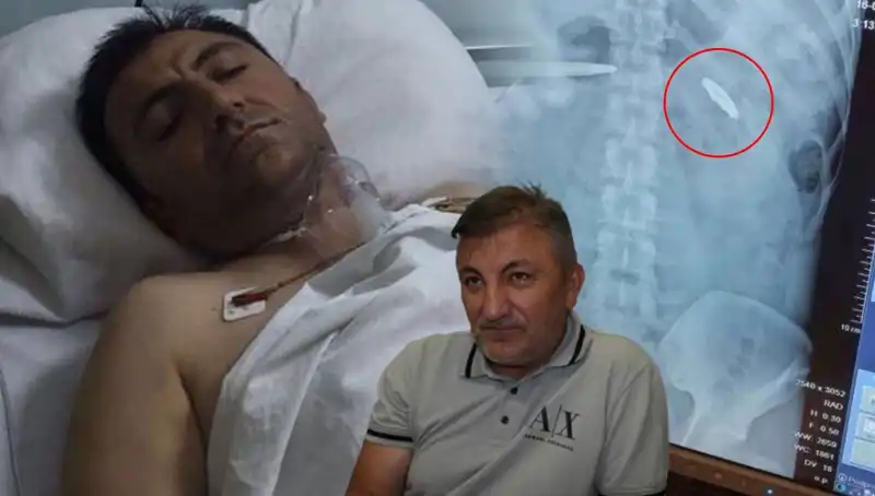 15 Temmuz Gecesinin Ardından: 9 Yıldır Taşıdığı Kurşunla Yaşamak